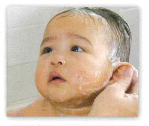 乳児のスキンケア すぎたファミリークリニック 兵庫県三田市の小児科 内科 旧 はばこどもクリニック