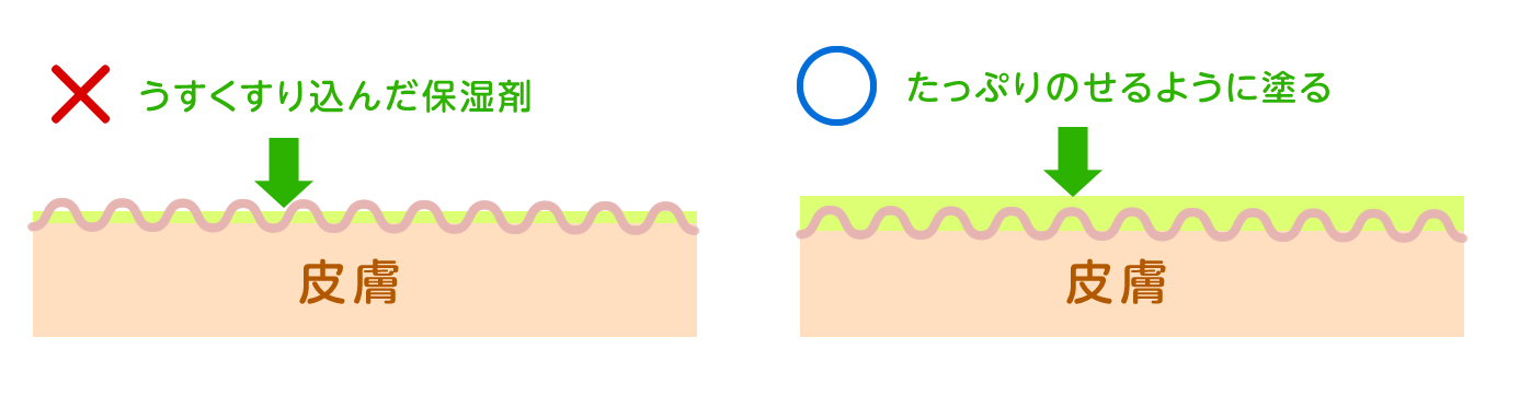 乳児のスキンケア すぎたファミリークリニック 兵庫県三田市の小児科 内科 旧 はばこどもクリニック